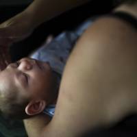 Puerto Rico resident Michelle Flandez caresses her 2-month-old son, Inti Perez, diagnosed with microcephaly linked to the mosquito-borne Zika virus, in Bayamon, Puerto Rico, in 2016. In the first long-term look at what happened to children of U.S. mothers who were infected with Zika during pregnancy, one in seven developed some kind of health problem — ranging from birth defects to conditions that became apparent only later. Health officials released the findings Tuesday. Study: 1 in 7 offspring of Zika-infected moms in U.S. territories have problems
