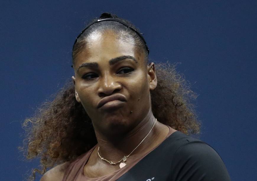 serena williams ugly outfit