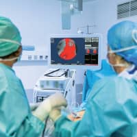 Lumicell software displays in real-time residual cancer during surgery.