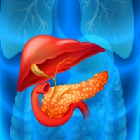 Pancreatic Cancer Picture Image