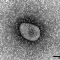 The omicron variant of the coronavirus as seen through a microscope