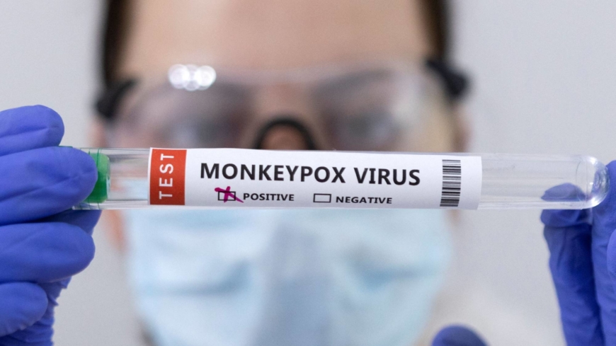 Monkeypox isn’t looking like a COVID-sized threat