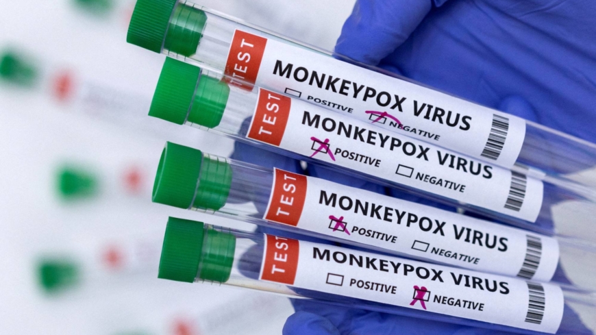 Japan steps up monkeypox surveillance amid growing outbreak in Europe