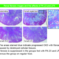 Renal fibrosis images and the effects of FK-23 and LFK
