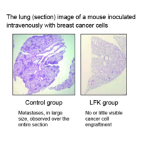 The lung (section) image of a mouse inoculated intravenously with breast cancer cells